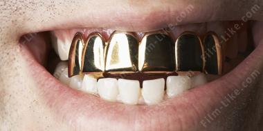 золотой зуб