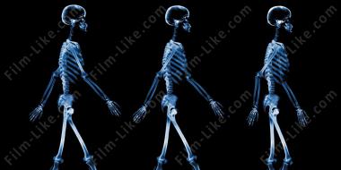 рентгеновский скелет