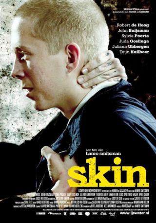 Скин (2008)
